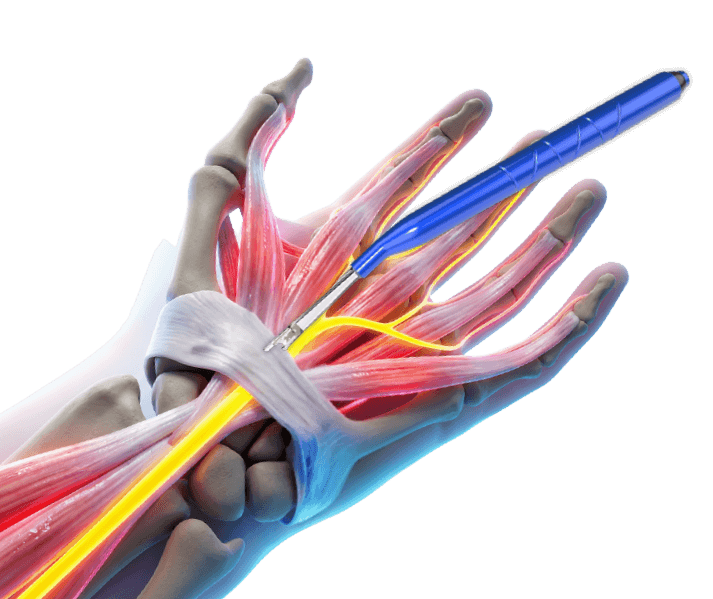 blade_x_tunel_do_carpo Blade X