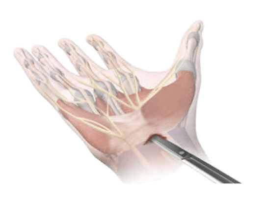 tecnica_antograda_2 (1)