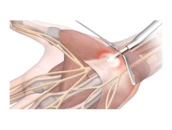 tecnica_antograda_3 (1)