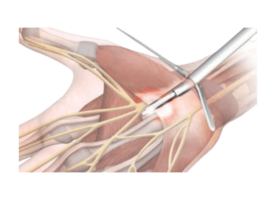 tecnica_antograda_4 (1)