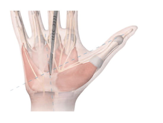 tecnica_retrograda_1 (1)