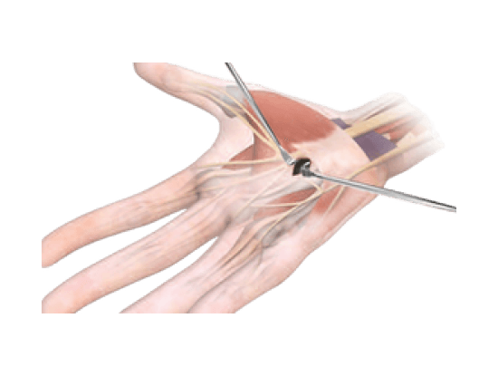 tecnica_retrograda_2 (1)