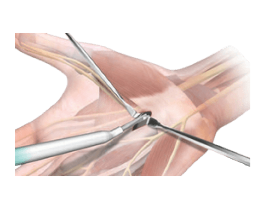 tecnica_retrograda_3 (1)