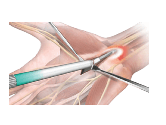 tecnica_retrograda_4 (1)