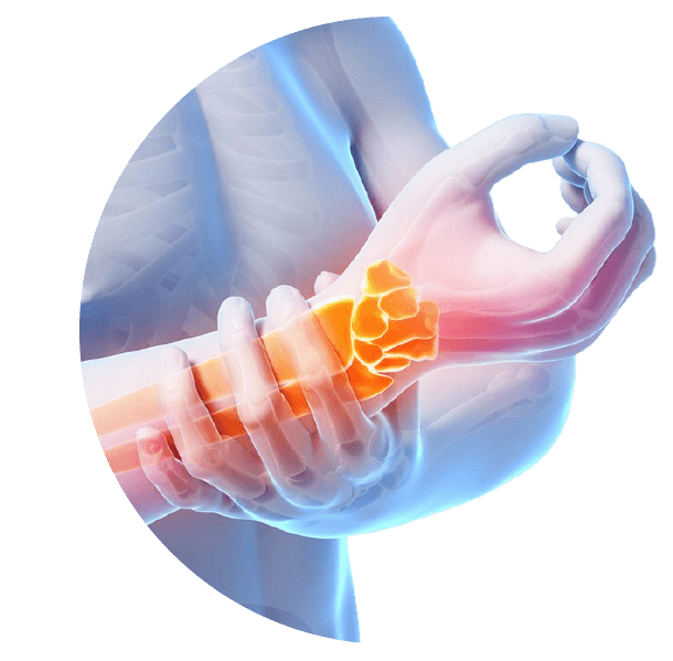 tunel_do_carpo Síndrome do Túnel do Carpo